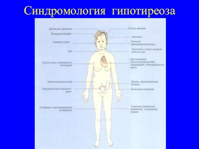 Синдромология гипотиреоза