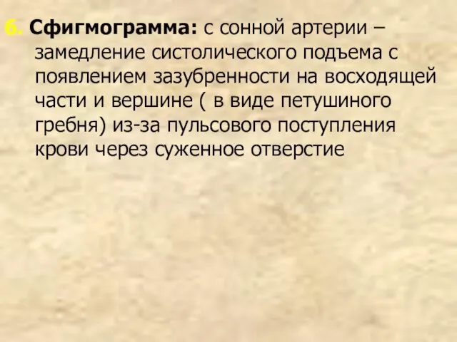 6. Сфигмограмма: c сонной артерии – замедление систолического подъема с появлением зазубренности