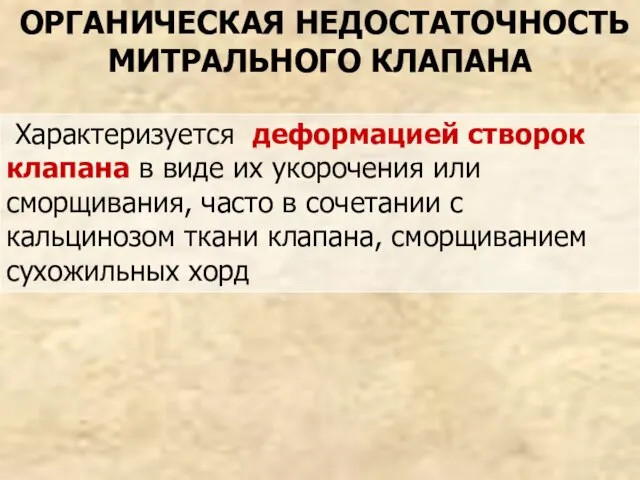 ОРГАНИЧЕСКАЯ НЕДОСТАТОЧНОСТЬ МИТРАЛЬНОГО КЛАПАНА Характеризуется деформацией створок клапана в виде их укорочения