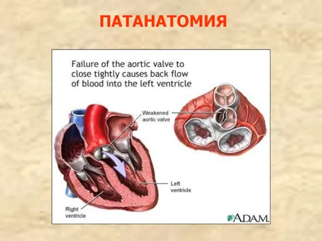 ПАТАНАТОМИЯ