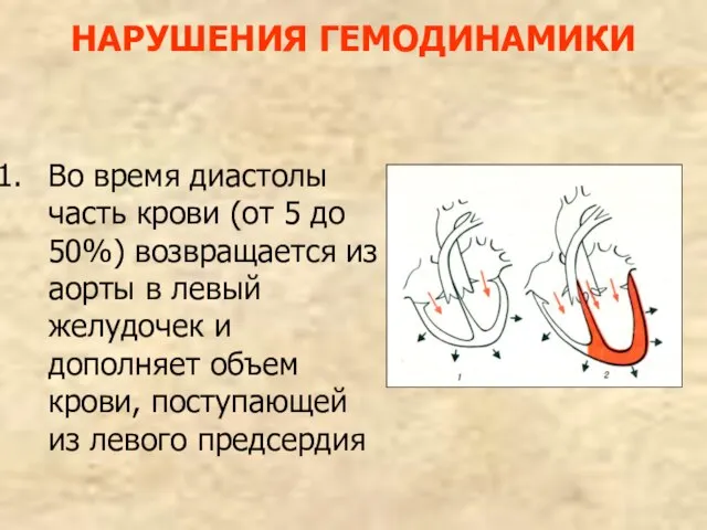 НАРУШЕНИЯ ГЕМОДИНАМИКИ Во время диастолы часть крови (от 5 до 50%) возвращается