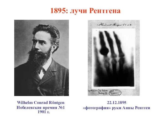 1895: лучи Рентгена Wilhelm Conrad Röntgen Нобелевская премия №1 1901 г. 22.12.1895 «фотография» руки Анны Рентген