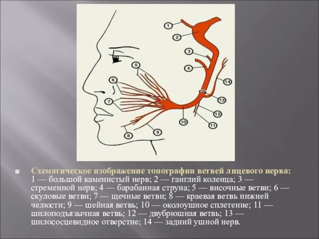 Схематическое изображение топографии ветвей лицевого нерва: 1 — большой каменистый нерв; 2