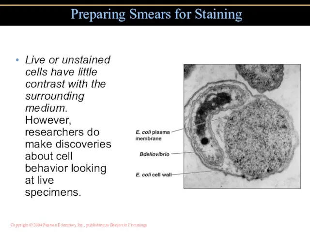 Live or unstained cells have little contrast with the surrounding medium. However,