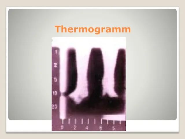 Thermogramm