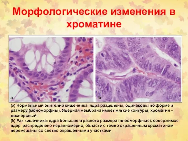 Морфологические изменения в хроматине (a) Нормальный эпителий кишечника: ядра разделены, одинаковы по