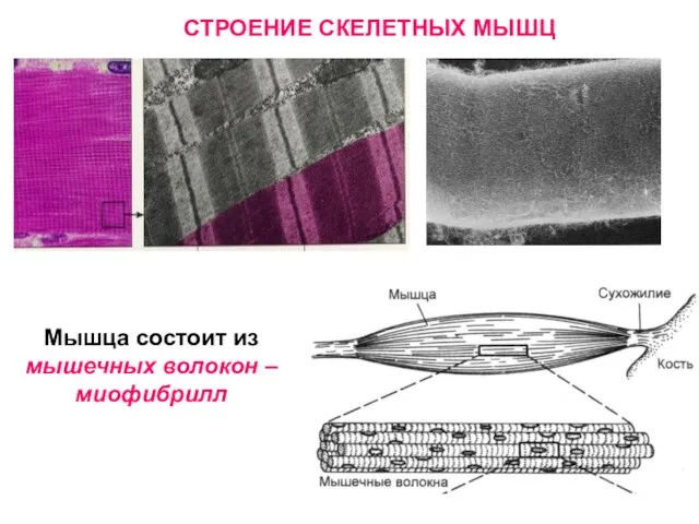 Мышца состоит из мышечных волокон – миофибрилл СТРОЕНИЕ СКЕЛЕТНЫХ МЫШЦ