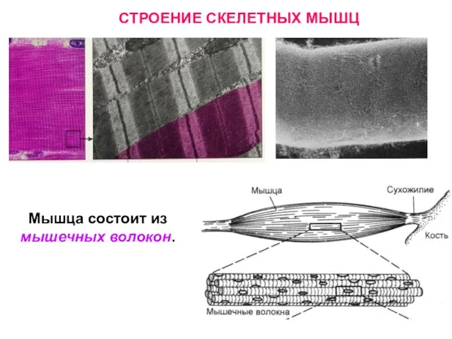 Мышца состоит из мышечных волокон. СТРОЕНИЕ СКЕЛЕТНЫХ МЫШЦ