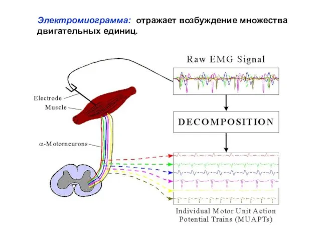 Электромиограмма: отражает возбуждение множества двигательных единиц.