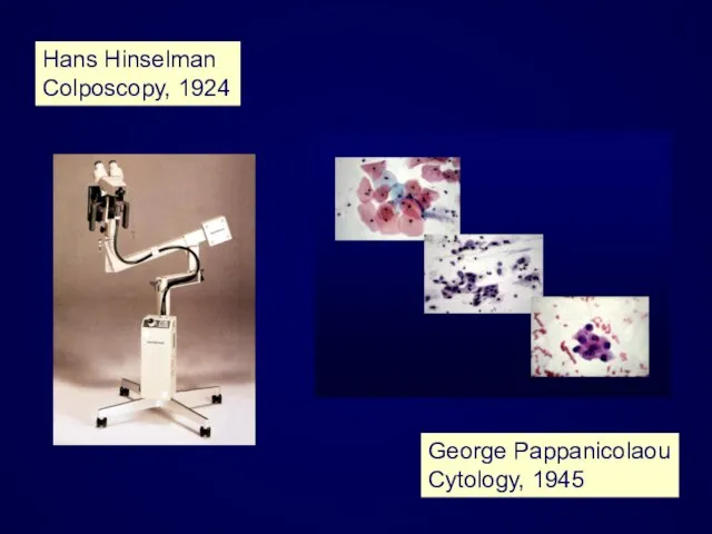Hans Hinselman Colposcopy, 1924 George Pappanicolaou Cytology, 1945