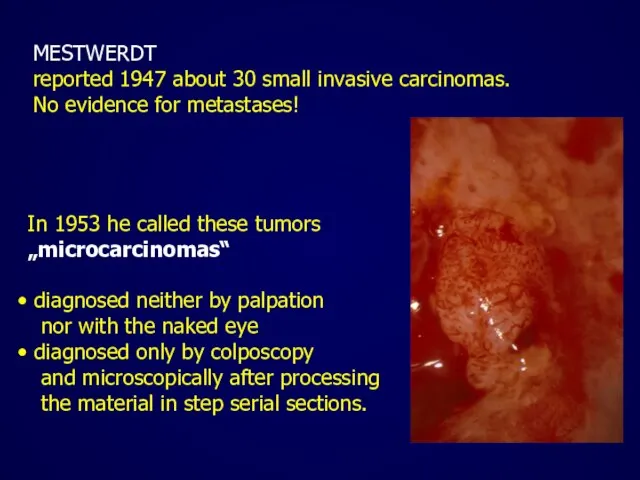 MESTWERDT reported 1947 about 30 small invasive carcinomas. No evidence for metastases!