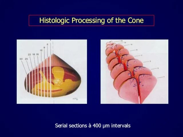 Histologic Processing of the Cone Serial sections à 400 μm intervals