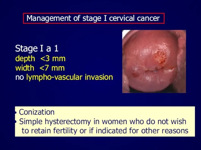 Management of stage I cervical cancer Stage I a 1 depth width