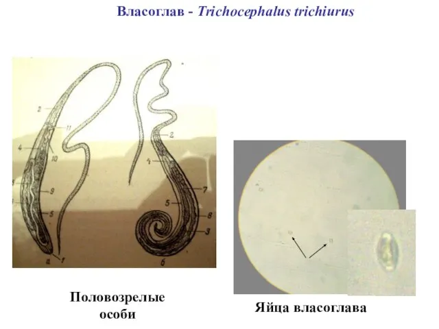 Власоглав - Trichocephalus trichiurus Яйца власоглава Половозрелые особи