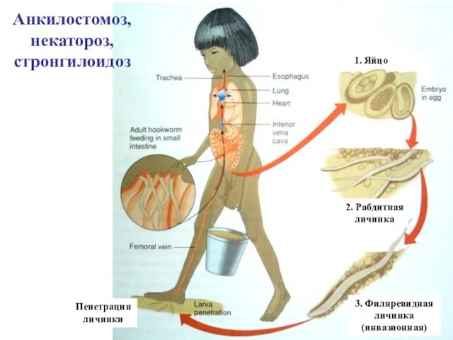 Анкилостомоз, некатороз, стронгилоидоз 2. Рабдитная личинка 1. Яйцо 3. Филяревидная личинка (инвазионная) Пенетрация личинки