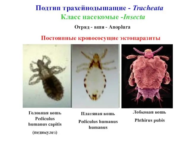 Подтип трахейнодышащие - Tracheata Класс насекомые -Insecta Отряд - вши - Anoplura