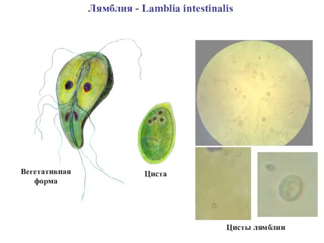 Цисты лямблии Лямблия - Lamblia intestinalis Циста Вегетативная форма