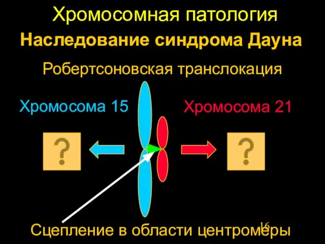 Хромосомная патология Наследование синдрома Дауна Хромосома 15 Робертсоновская транслокация Сцепление в области центромеры Хромосома 21