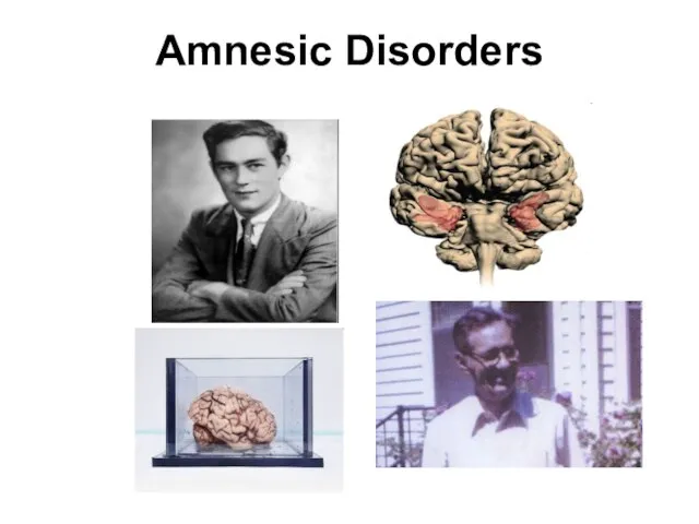 Amnesic Disorders