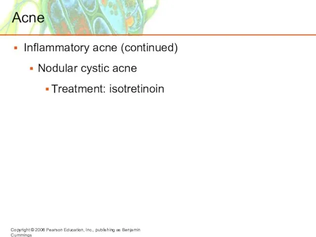 Acne Inflammatory acne (continued) Nodular cystic acne Treatment: isotretinoin