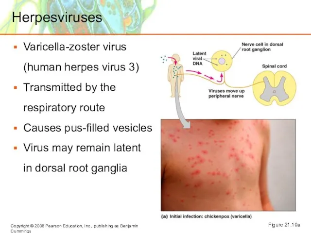 Herpesviruses Varicella-zoster virus (human herpes virus 3) Transmitted by the respiratory route