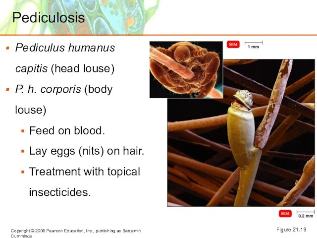 Pediculosis Pediculus humanus capitis (head louse) P. h. corporis (body louse) Feed