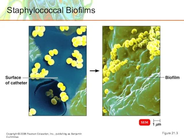 Staphylococcal Biofilms Figure 21.3