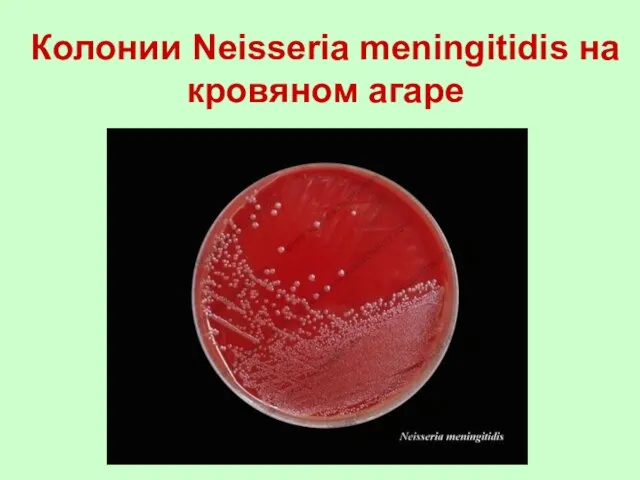 Колонии Neisseria meningitidis на кровяном агаре