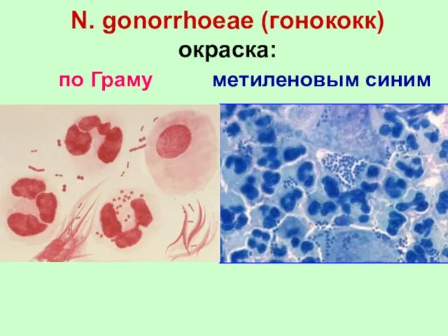 N. gonorrhoeae (гонококк) окраска: по Граму метиленовым синим