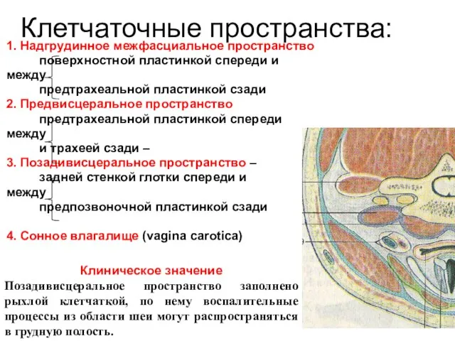 Клетчаточные пространства: 1. Надгрудинное межфасциальное пространство поверхностной пластинкой спереди и между предтрахеальной