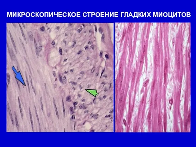 МИКРОСКОПИЧЕСКОЕ СТРОЕНИЕ ГЛАДКИХ МИОЦИТОВ