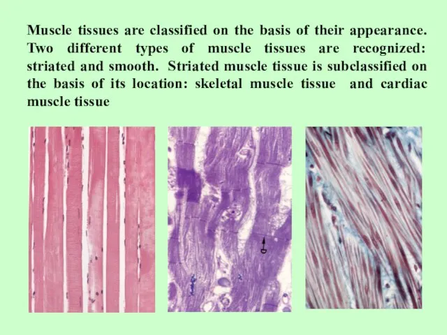 Muscle tissues are classified on the basis of their appearance. Two different