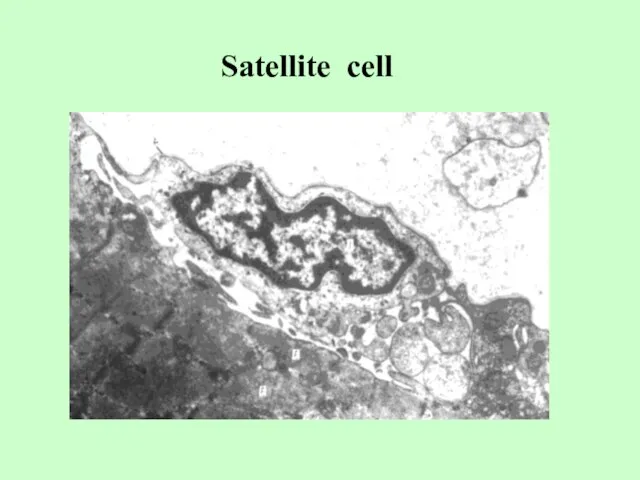 Satellite cell