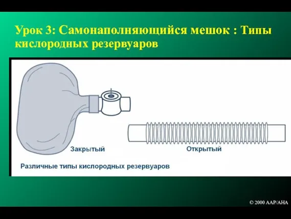 Урок 3: Самонаполняющийся мешок : Типы кислородных резервуаров © 2000 AAP/AHA