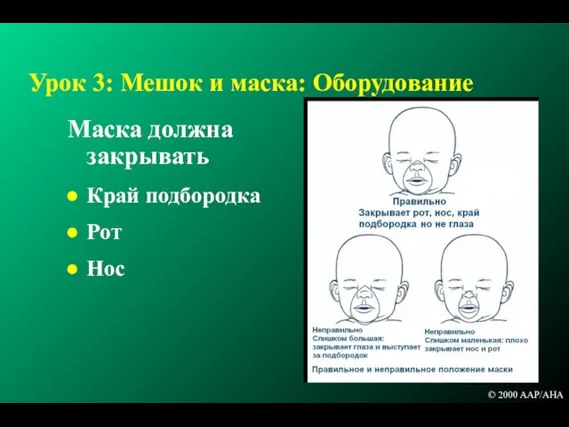 Урок 3: Мешок и маска: Оборудование Маска должна закрывать Край подбородка Рот Нос © 2000 AAP/AHA