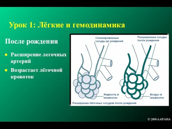 Урок 1: Лёгкие и гемодинамика После рождения Расширение легочных артерий Возрастает лёгочной кровоток © 2000 AAP/AHA