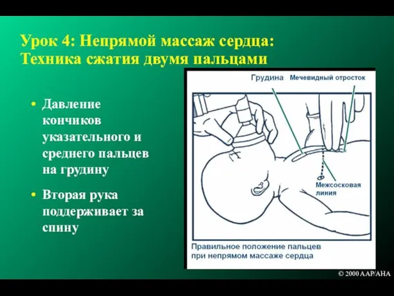 Урок 4: Непрямой массаж сердца: Техника сжатия двумя пальцами Давление кончиков указательного