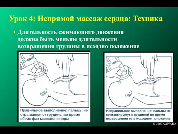 Урок 4: Непрямой массаж сердца: Техника Длительность сжимающего движения должна быть меньше