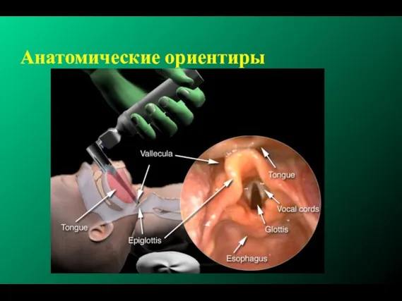 Анатомические ориентиры