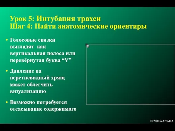 Урок 5: Интубация трахеи Шаг 4: Найти анатомические ориентиры Голосовые связки выгладят