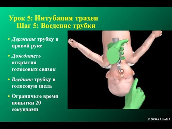 Урок 5: Интубация трахеи Шаг 5: Введение трубки Держите трубку в правой