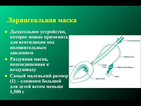 Ларингеальная маска Дыхательное устройство, которое можно применять для вентиляции под положительным давлением