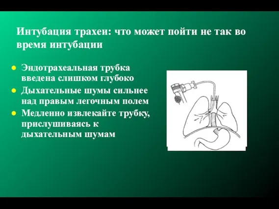 Интубация трахеи: что может пойти не так во время интубации Эндотрахеальная трубка