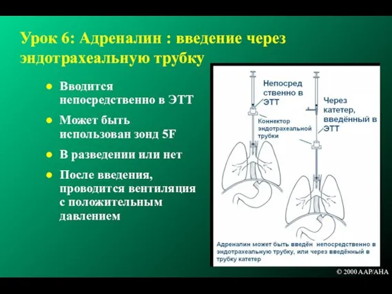 Урок 6: Адреналин : введение через эндотрахеальную трубку Вводится непосредственно в ЭТТ