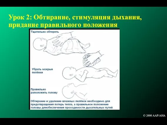 Урок 2: Обтирание, стимуляция дыхания, придание правильного положения © 2000 AAP/AHA