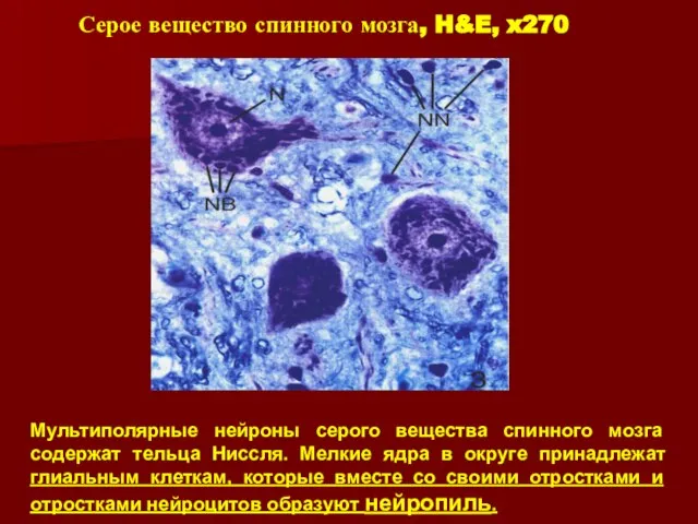 Серое вещество спинного мозга, H&E, x270 Мультиполярные нейроны серого вещества спинного мозга