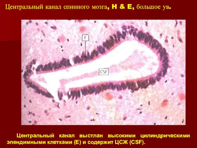 Центральный канал спинного мозга, H & E, большое ув. Центральный канал выстлан