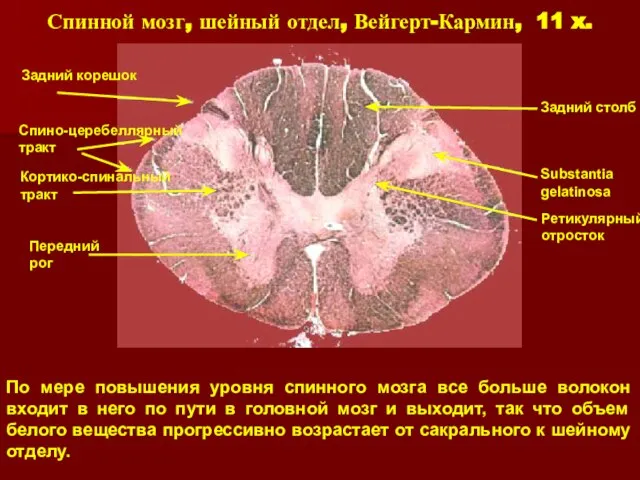 Спинной мозг, шейный отдел, Вейгерт-Кармин, 11 x. По мере повышения уровня спинного