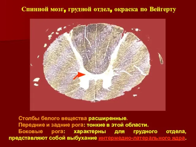 Столбы белого вещества расширенные. Передние и задние рога: тонкие в этой области.