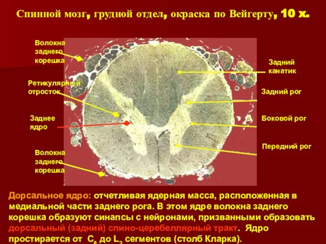 Спинной мозг, грудной отдел, окраска по Вейгерту, 10 x. Дорсальное ядро: отчетливая